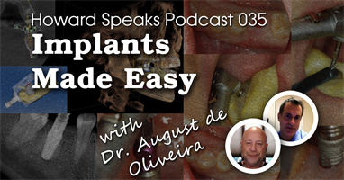 Implants Made Easy with Dr. August de Oliveira : Howard Speaks Podcast #35