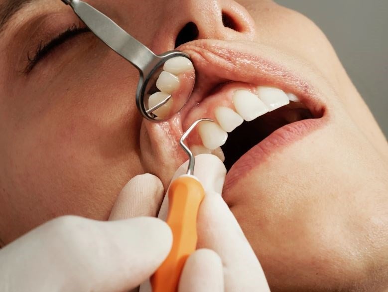 Look at These Dental Tips to Avoid Future Dental Problems