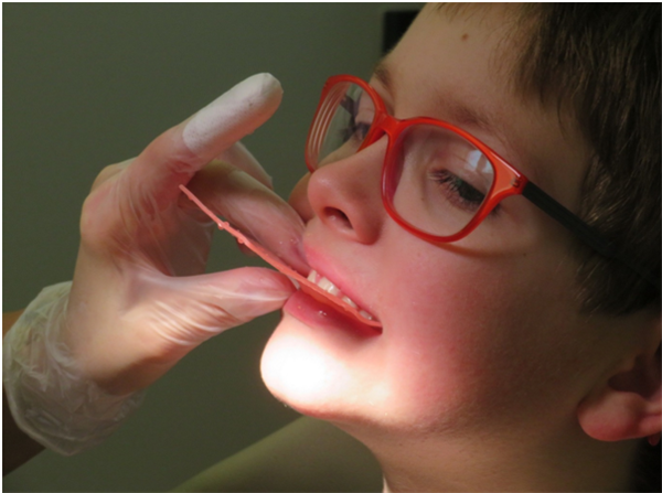 5 Different Types of Braces for Kids
