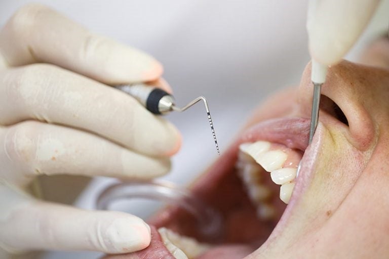Procedures that a Periodontist Performs