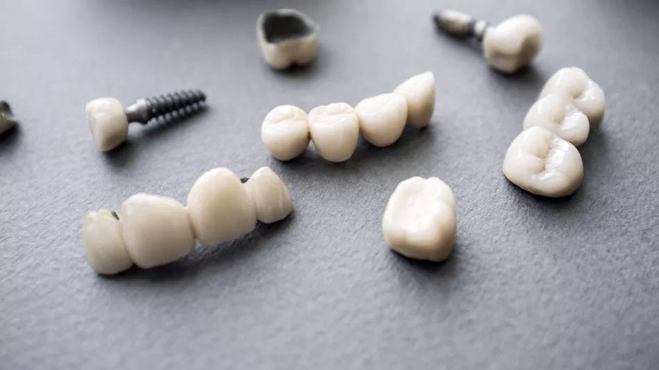 Intelligent Dental Implants for a Longer Lifespan