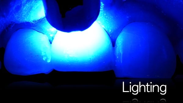 The   One-Time   Socket   Abutment Just    For   Incisor