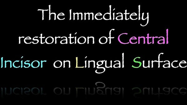 The Immediately  restoration of Central Incisor  on Lingual  Surface 