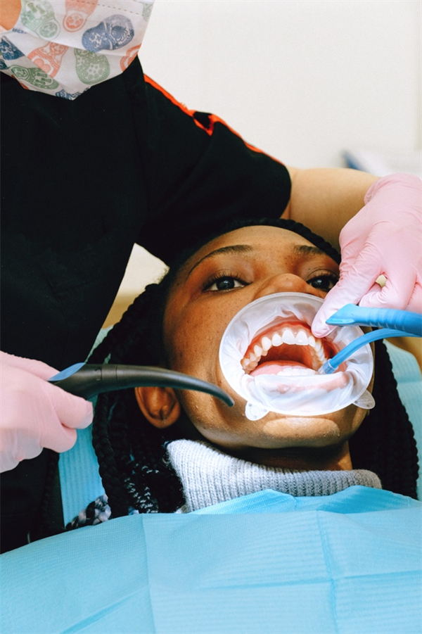 Why You Must Get a Professional Teeth Cleaning Service