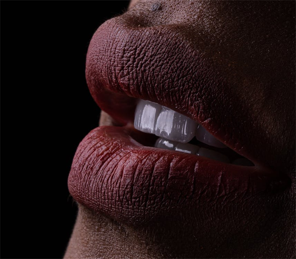 How Poor Oral Health Can Lead to Mouth Ulcers and Canker Sores